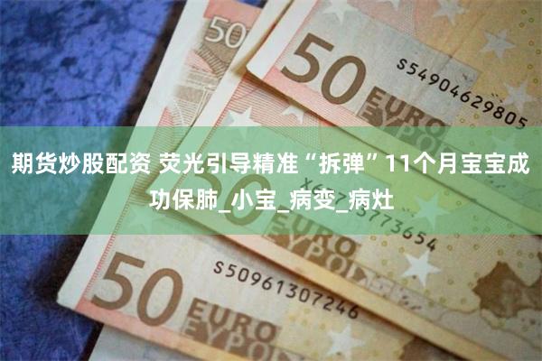 期货炒股配资 荧光引导精准“拆弹”11个月宝宝成功保肺_小宝_病变_病灶